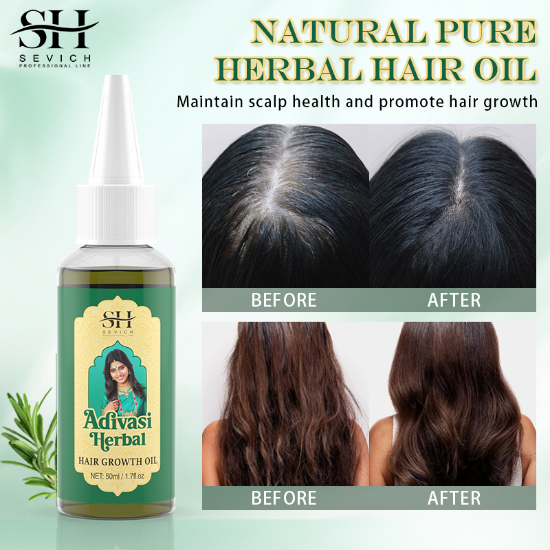 Ayurvedic Hair Growth Oil Adiv - Ayurvedic & Herbal Wellness Kits avaliação e preço