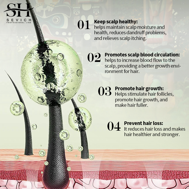 Sevich India Herbal Hair Growt - Ayurvedic & Herbal Wellness Kits avaliação e preço