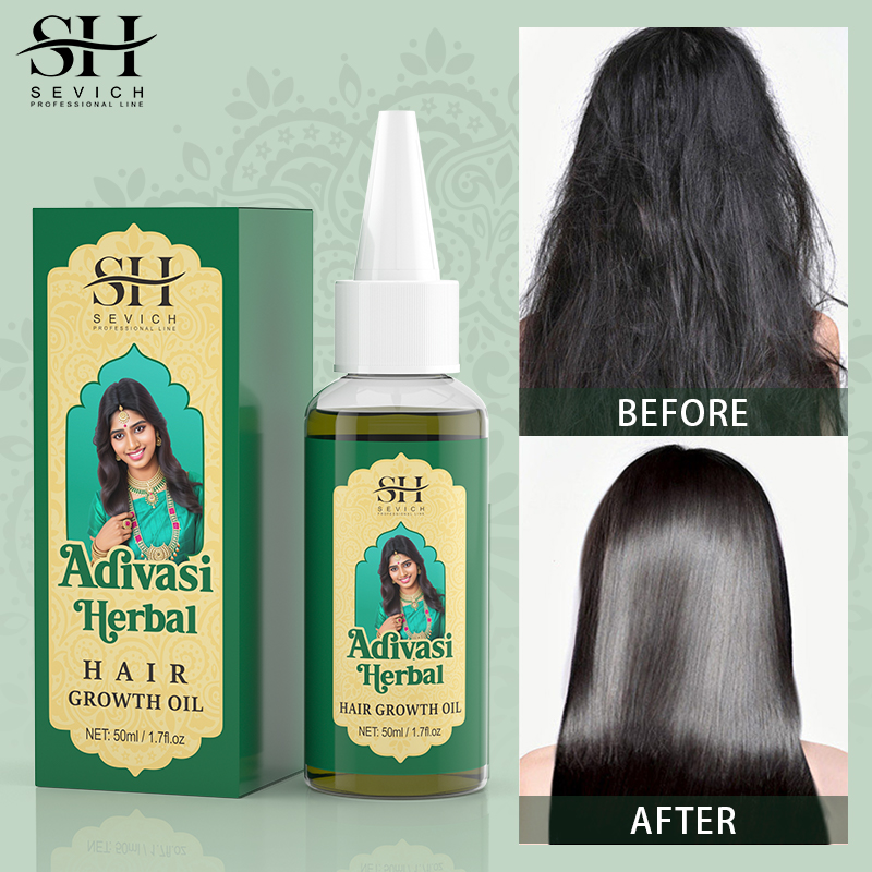 Sevich India Herbal Hair Growt - Ayurvedic & Herbal Wellness Kits avaliação e preço